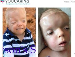 Tega! Ada Orang Iseng Pakai Foto Bocah dengan Kondisi Medis Serius Jadi Meme