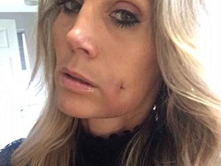 Wanita Ini Habiskan Rp 22 Jutaan Agar Punya Lesung Pipit Seperti Anaknya