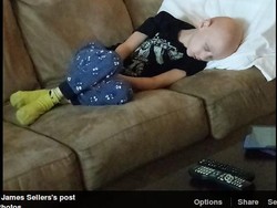 Foto Anak dengan Kanker Langka Setelah Jalani Kemoterapi Ini Bikin Terenyuh
