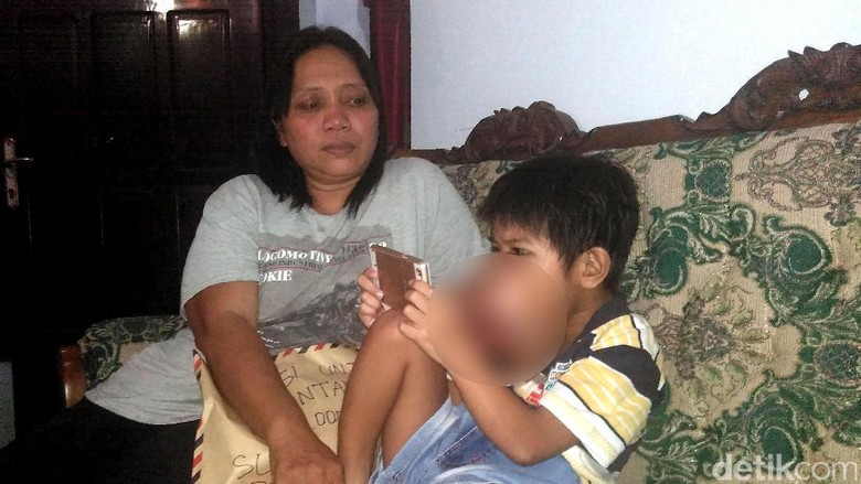 Shinwan Bintang, bocah 7 tahun pengidap tumor gusi