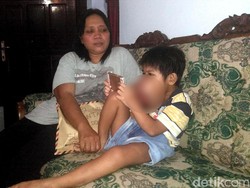 Derita Bintang, Bocah 7 Tahun Idap Tumor di Gusi