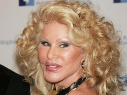 Kisah Sosialita Kecanduan Operasi Plastik yang Kini Punya $0 di Rekening