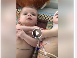 Momen Haru Saat Kembar Dempet Kepala Bisa Saling Pandang Ini Jadi Viral