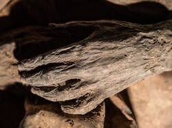 4 Penyakit Ini Diketahui Sudah Ada Sejak Zaman Kuno