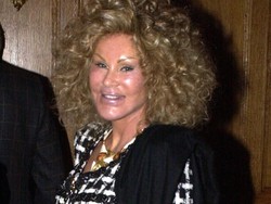 Foto: Mengenal Jocelyn, Sosialita Kecanduan Oplas Hingga Skandal Cinta