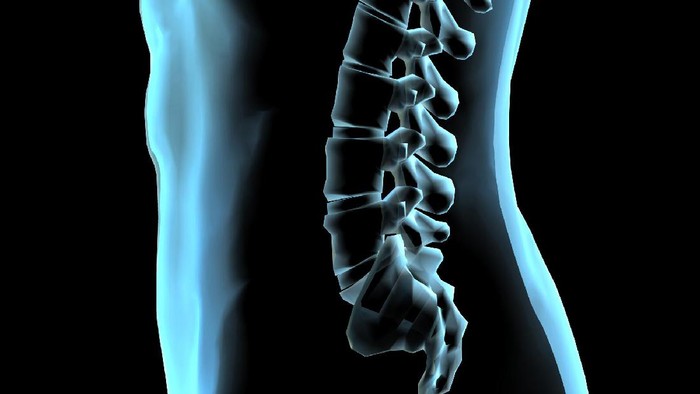 Tulang belakang memang tidak ada yang sangat lurus. (Foto: iStock)