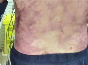 Kena Infeksi Langka dari Liur Anjing, David Koma Sampai 6 Minggu