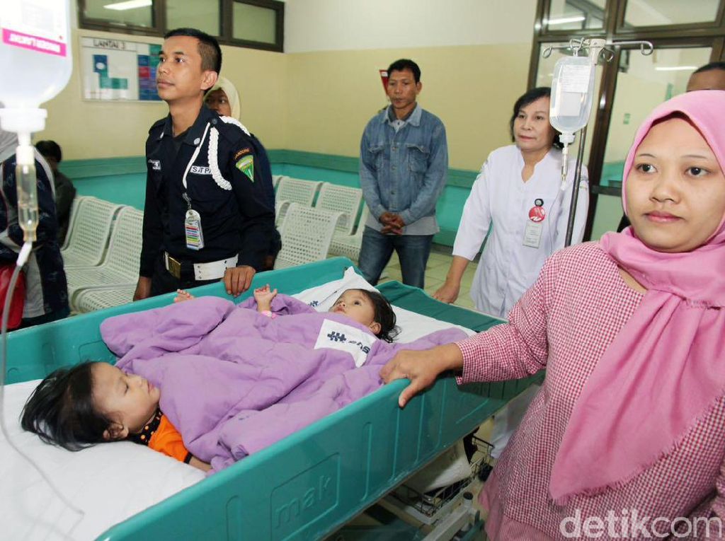 20 Jam Operasi, Bayi Kembar Dempet Pinggul Devina dan Devani Berhasil Dipisahkan 20 Jam Operasi, Bayi Kembar Dempet Pinggul Devina dan Devani Berhasil Dipisahkan