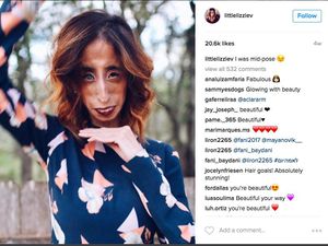 Tega! Perempuan dengan Kondisi Langka Jadi Bahan Olok-olok di Dunia Maya