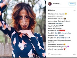 Tega! Perempuan dengan Kondisi Langka Jadi Bahan Olok-olok di Dunia Maya