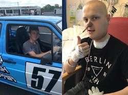 Lika-liku Adam Sembuhkan Benjolan Sebesar Jeruk di Pipinya