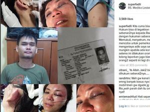 Farah Dibba Masih Syok dan Kondisi Penglihatan Burem