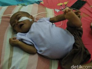 Yuk! Bantu Naura, Bayi dengan Atresia Bilier dan Gizi Buruk Yuk! Bantu Naura, Bayi dengan Atresia Bilier dan Gizi Buruk