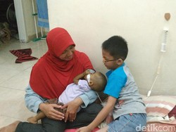 Alami Gizi Buruk dan Atresia Bilier, Bayi Naura Butuh Bantuan