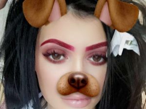 Wanita Kini Operasi Plastik Bukan Ingin Mirip Artis, Tapi Filter Snapchat