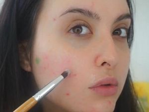 Cara Vlogger Kecantikan Hilangkan Jerawat Dalam Sekejap: Pakai Eyeshadow Hijau