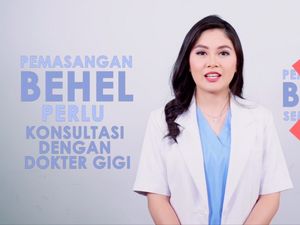 Video: Jangan Asal Ikut-ikutan Ya, Kenali Dulu Untung Rugi Pasang Behel