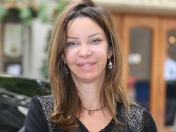 300 Kali Operasi Plastik, Wanita Ini Diejek Anaknya Mirip Monster