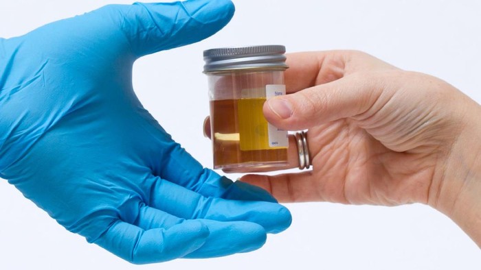 Ilustrasi tes urine Ilustrasi tes urine