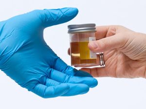 Urine Berbusa Tanda Penyakit Apa? Ini Kemungkinan Penyebabnya Urine Berbusa Tanda Penyakit Apa? Ini Kemungkinan Penyebabnya