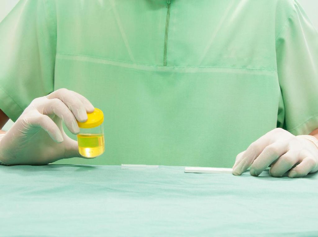 Deteksi Dini Kanker Serviks dengan Pap Smear Mungkin Bisa Diganti Tes Urine