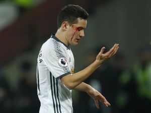 Tiga Poin MU, Tiga Jahitan Herrera