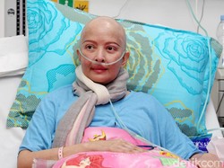 Kondisi Kesehatan Yana Zein Tengah Ngedrop