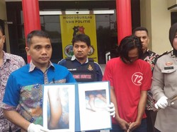 Main Game Online Terganggu, Bocah 5 Tahun Disundut Rokok