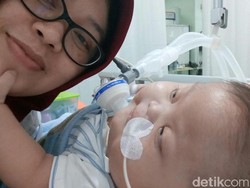 Paru-parunya Kaku, Balita 14 Bulan Ini Butuh Home Ventilator