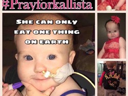 Kallista, Balita Lucu yang Hanya Bisa Minum ASI Khusus