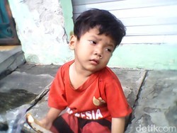 Kisah Marcel, Bocah Telantar di Tangerang dan Kepedulian Tetangga