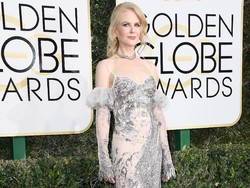 7 Selebriti dengan Penampilan Terburuk di Golden Globes 2017
