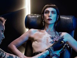 Kisah Samantha dan Bekas Mastektominya yang Indah