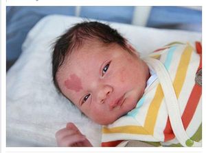 Cute! Bayi Ini Punya Tanda Lahir Berbentuk Hati di Dahinya