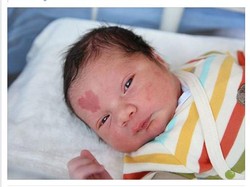 Cute! Bayi Ini Punya Tanda Lahir Berbentuk Hati di Dahinya