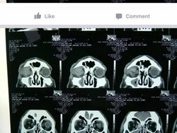 Viral! Pengroyokan WN Rusia di Bali Hingga Matanya Buta Sebelah