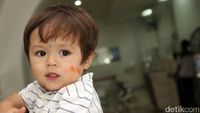Muka Cemong El Barack