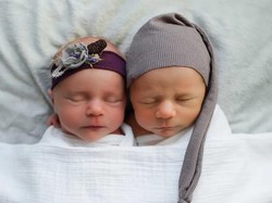 Kisah Sedih di Balik Foto Mempesona Sepasang Bayi Kembar