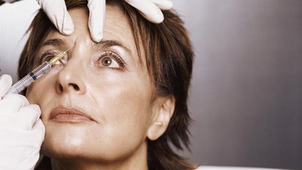 ilustrasi botox