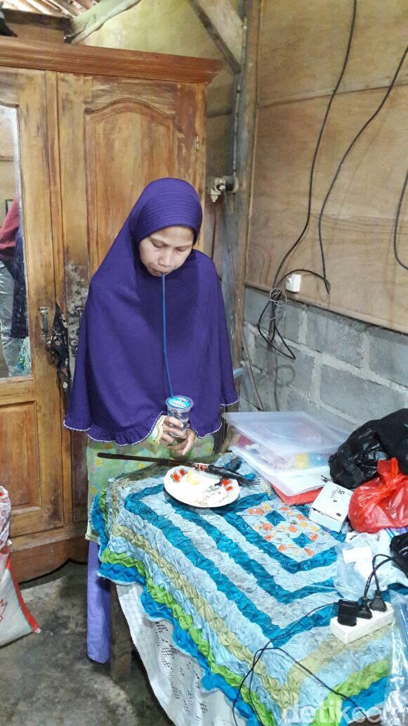 Sulami, warga Selorejo RT 31/11 Mojokerto, Kedawung, Sragen yang mengalami kelainan sehingga sekujur tubuhnya kaku