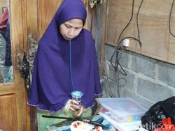 Kisah Perjuangan Hidup Sulami Manusia Kayu Sejak Kelas 4 SD