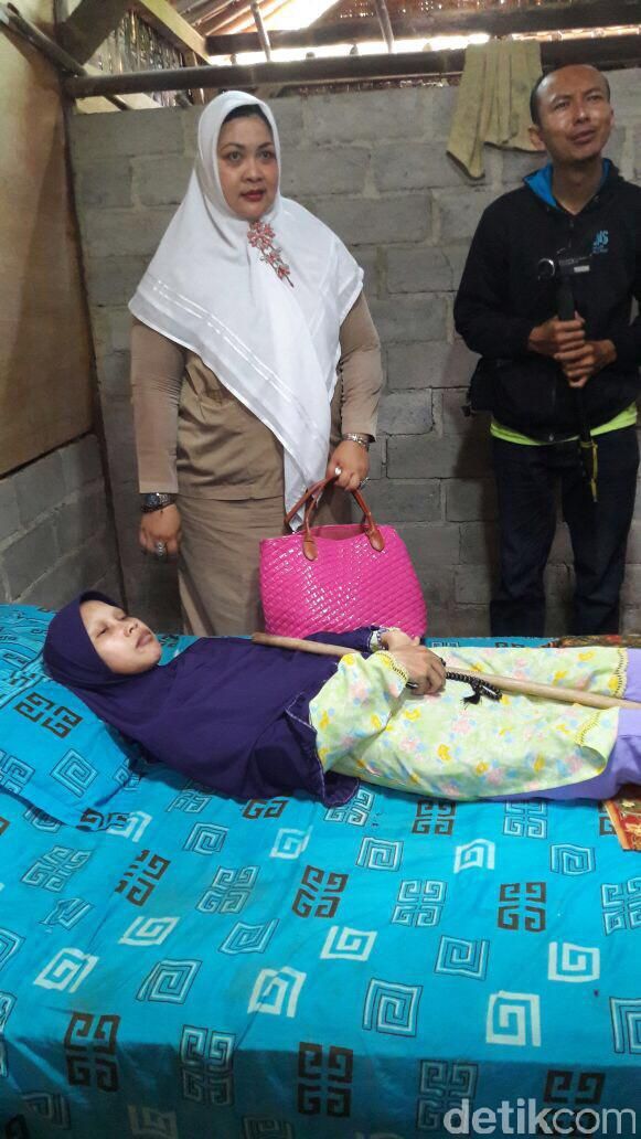 Sulami, warga Selorejo RT 31/11 Mojokerto, Kedawung, Sragen yang mengalami kelainan sehingga sekujur tubuhnya kaku