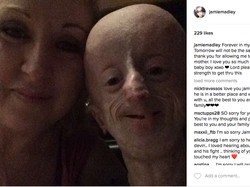 Kisah Pria Berwajah Kakek-kakek yang Meninggal di Usia 20 Tahun