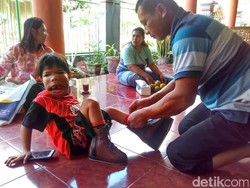 Berhasil Dioperasi, Bintang Ingin Sekolah dan Berganti Nama