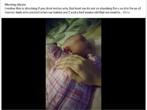 Dikira Menyakiti Bayinya, Padahal Ibu Ini Sedang Memberi Terapi