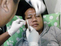 Bripka Erwan yang Diserang Tahanan Kabur Alami Luka di Wajah