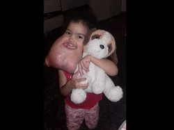 Akhirnya Tumor 2 Kg di Wajah Bocah Ini Berhasil Diangkat