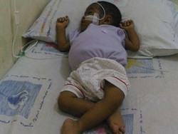 Bantu Bayi Naura Pengidap Atresia Bilier untuk Jalani Transplantasi Hati