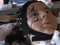 Komputer Pembaca Pikiran Bisa Bantu Pasien Lumpuh Total