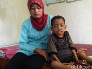 Baru Dirawat 12 Jam, Bocah Gizi Buruk asal Sukabumi Ini Meninggal